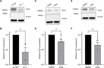 The DNA repair kinase ATM regulates CD13 expression and cell migration